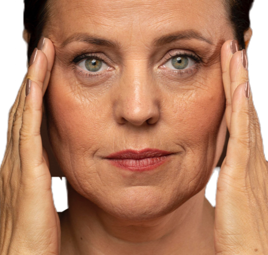 Imagem da especialidade: Derretimento facial